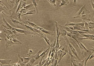 A microscopy image of several endometrial stromal fibroblasts